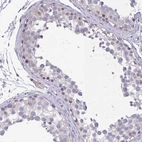 Immunohistochemical staining of human testis shows moderate nuclear positivity in cells in seminiferous ducts and Leydig cells.