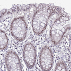 Immunohistochemical staining of human colon shows moderate nuclear positivity in glandular cells.