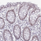 Immunohistochemical staining of human colon shows moderate nuclear positivity in glandular cells.