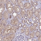 Immunohistochemical staining of human kidney shows moderate nuclear positivity in cells in tubules.