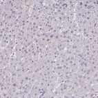 Immunohistochemical staining of human liver shows no positivity in hepatocytes as expected.