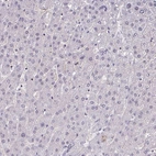 Immunohistochemical staining of human liver shows no positivity in hepatocytes as expected.