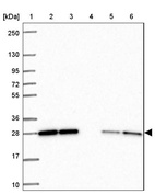 Anti-RBL1 Antibody