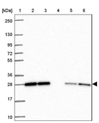 Lane 1: Marker [kDa] 250, 130, 95, 72, 55, 36, 28, 17, 10_br/_Lane 2: Human cell line RT-4_br/_Lane 3: Human cell line U-251MG sp_br/_Lane 4: Human plasma (IgG/HSA depleted)_br/_Lane 5: Human liver tissue_br/_Lane 6: Human tonsil tissue
