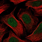 Immunofluorescent staining of human cell line U-2 OS shows localization to nucleoplasm.