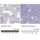 Anti-TMCO5A Antibody