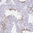 Anti-TMCO5A Antibody