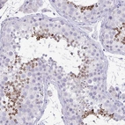 Immunohistochemical staining of human testis shows high expression.
