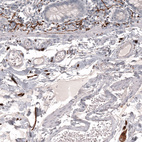 Anti-L1CAM Antibody