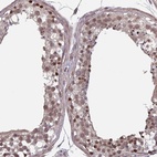 Anti-IPO5 Antibody