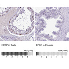 Anti-EPOP Antibody