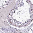 Immunohistochemical staining of human testis shows strong nuclear/ cytoplasmic positivity in spermatogonia.