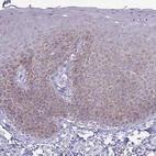 Immunohistochemical staining of human skin shows moderate cytoplasmic positivity in squamous epithelial cells.