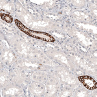 Immunohistochemical staining of human kidney shows strong membranous positivity in a subset of cells in tubules.