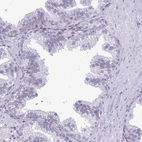Immunohistochemical staining of human prostate shows no positivity in glandular cells as expected.