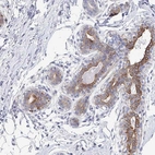Anti-KLHL33 Antibody