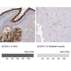 Anti-ELOVL1 Antibody