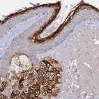 Immunohistochemical staining of human skin shows strong granular cytoplasmic positivity in sebaceous gland and keratinocytes.