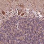 Anti-CSNK1G2 Antibody