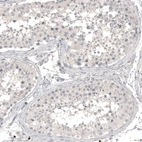 Immunohistochemical staining of human testis shows no positivity in cells in seminiferous ducts as expected.
