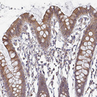 Immunohistochemical staining of human colon shows moderate cytoplasmic positivity in glandular cells.