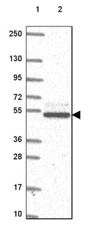 Lane 1: Marker [kDa] 250, 130, 95, 72, 55, 36, 28, 17, 10_br/_Lane 2: Human cell line RT-4