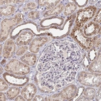 Immunohistochemical staining of human kidney shows moderate cytoplasmic positivity in cells in tubules.