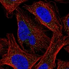 Immunofluorescent staining of human cell line U-2 OS shows localization to vesicles.