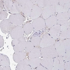 Immunohistochemical staining of human skeletal muscle shows no positivity in striated muscle fibers as expected.
