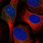 Immunofluorescent staining of human cell line U-2 OS shows localization to endoplasmic reticulum.