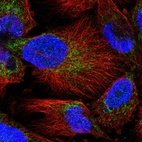 Anti-MARCH5 Antibody