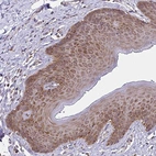 Immunohistochemical staining of human skin shows moderate cytoplasmic/membranous positivity in squamous epithelial cells.