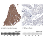 Anti-L1CAM Antibody