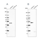 Anti-COQ2 Antibody