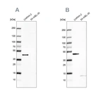 Anti-COQ2 Antibody