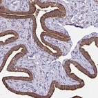 Immunohistochemical staining of human fallopian tube shows strong cytoplasmic/membranous positivity in glandular cells.