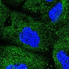 Immunofluorescent staining of human cell line A-431 shows localization to cytosol.