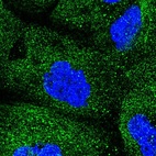 Anti-COQ2 Antibody