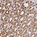 Anti-ZNF526 Antibody