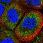 Immunofluorescent staining of human cell line A-431 shows localization to cytosol.