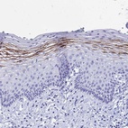 Anti-FA2H Antibody