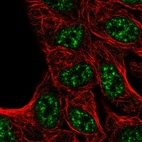 Immunofluorescent staining of human cell line RT4 shows localization to nuclear speckles.