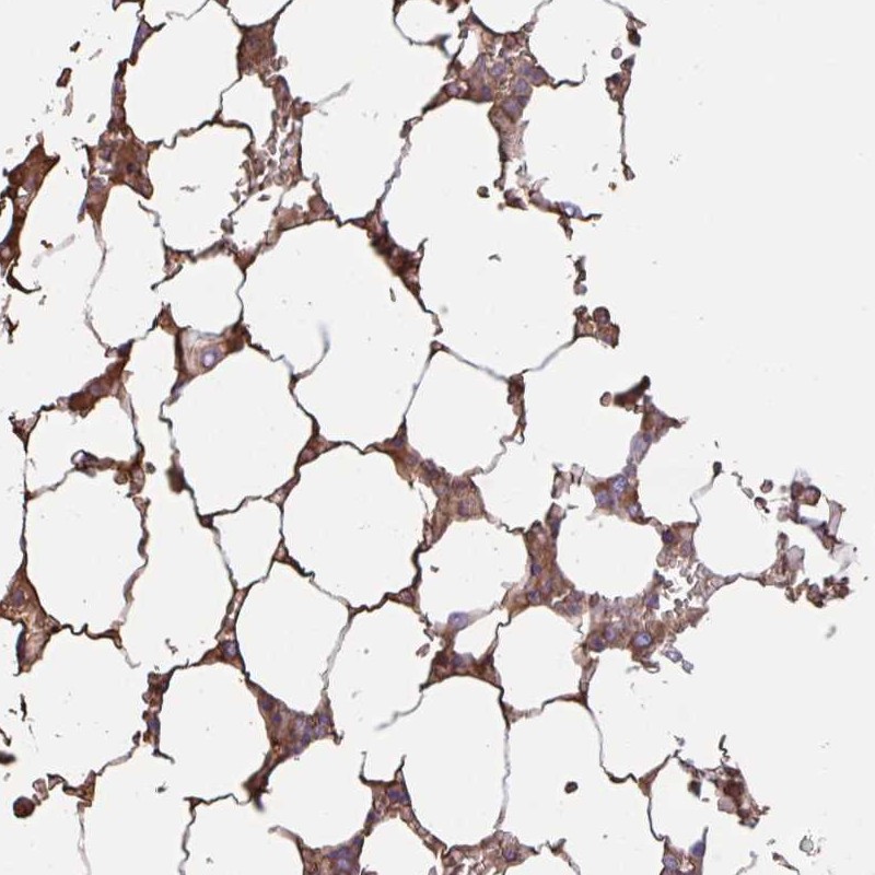 Anti-LARGE2 Antibody