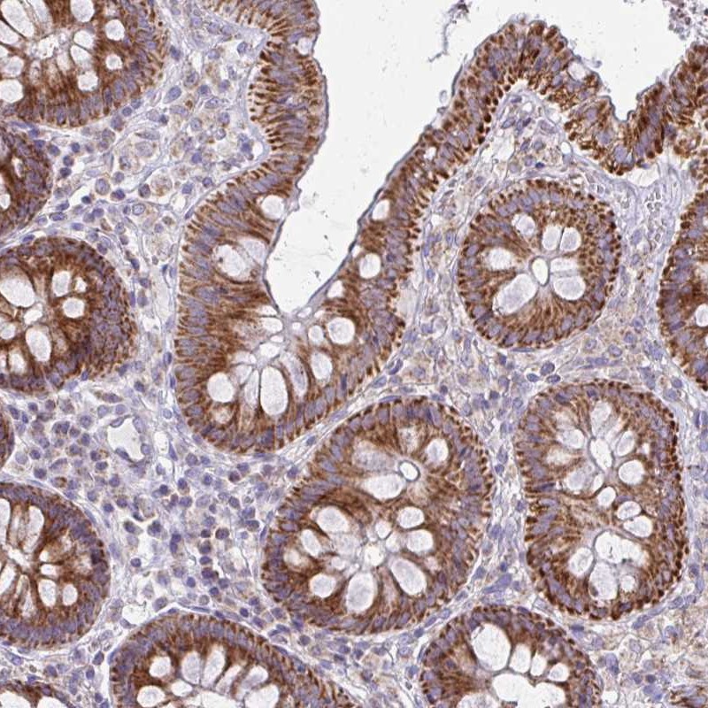 Anti-MRPL19 Antibody
