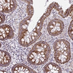 Anti-MRPL19 Antibody