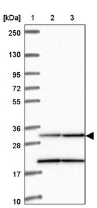 Lane 1: Marker [kDa] 250, 130, 95, 72, 55, 36, 28, 17, 10_br/_Lane 2: Human cell line RT-4_br/_Lane 3: Human cell line U-251MG sp