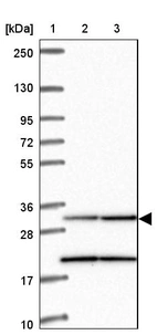 Lane 1: Marker [kDa] 250, 130, 95, 72, 55, 36, 28, 17, 10_br/_Lane 2: Human cell line RT-4_br/_Lane 3: Human cell line U-251MG sp