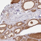 Anti-ZNF33A Antibody