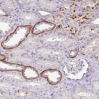 Anti-OR6N2 Antibody