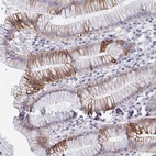 Anti-FAM156A Antibody